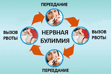 Лечение булимии в Шарыпово